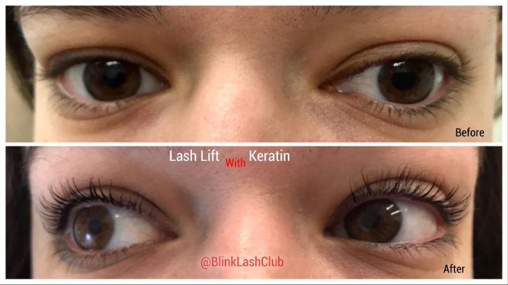 Organic Lash Lift – Your Central Guide Towards A Viable Lash Lift Solution