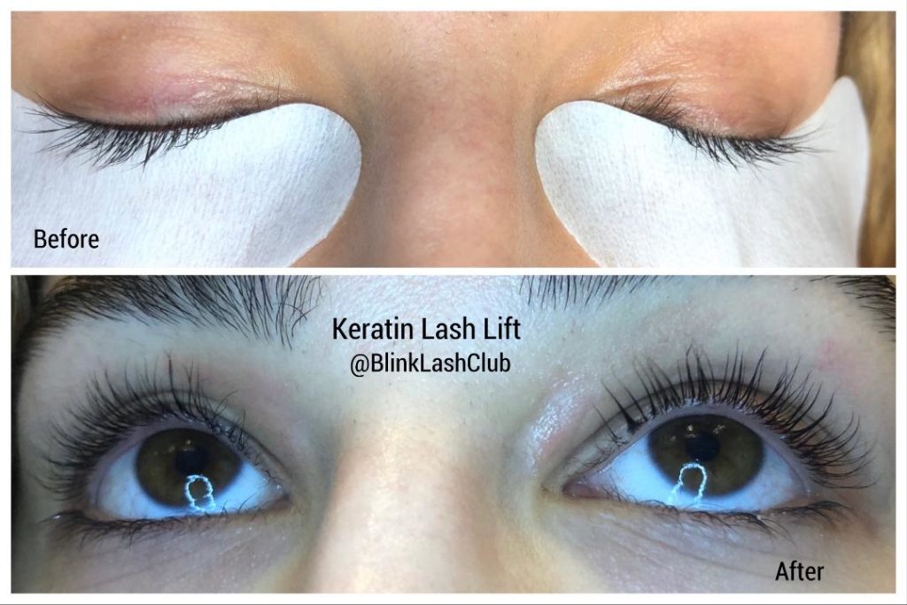 Organic Lash Lift – How To Combine This Natural Treatment With Various Others