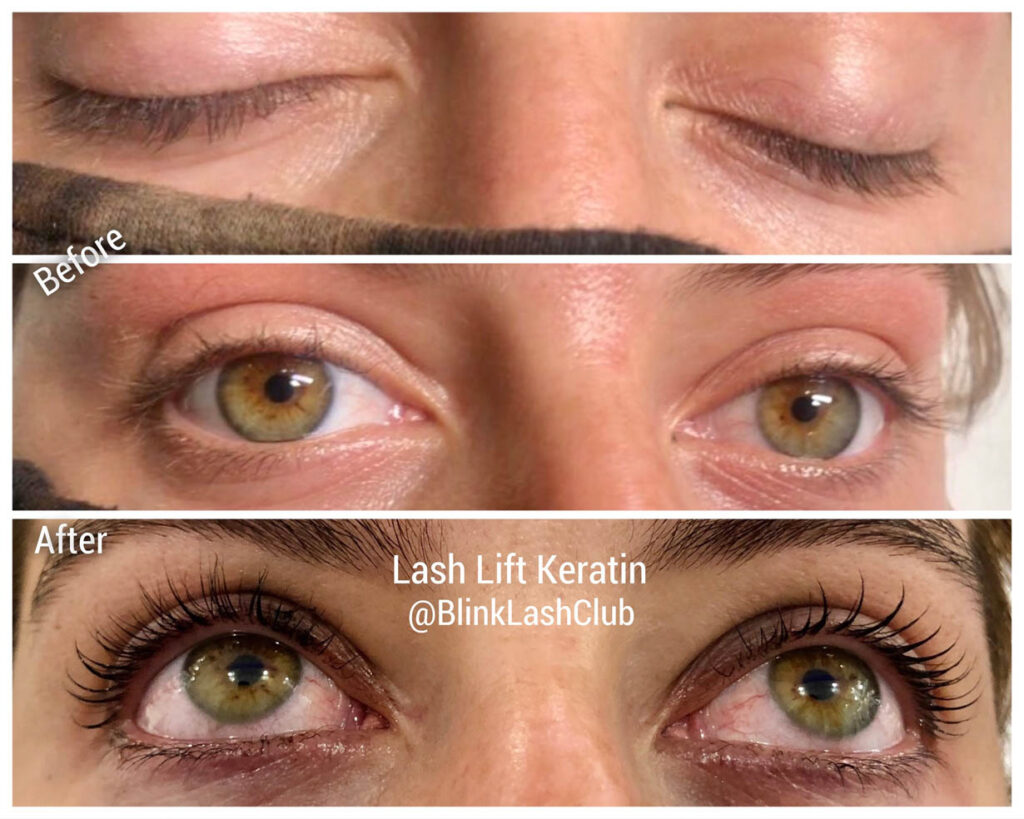 Lash Lift – A Procedure That Can Make Your Eyes Look Sharp