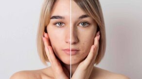 Collagen Facials Benefits for Skin Health