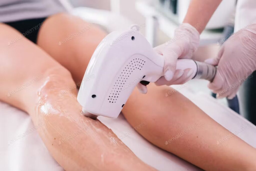 hair removal, the world of organic sugaring