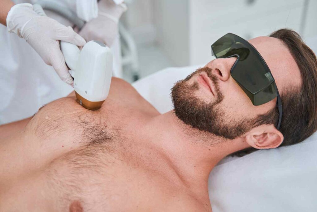 body hair removal for men 