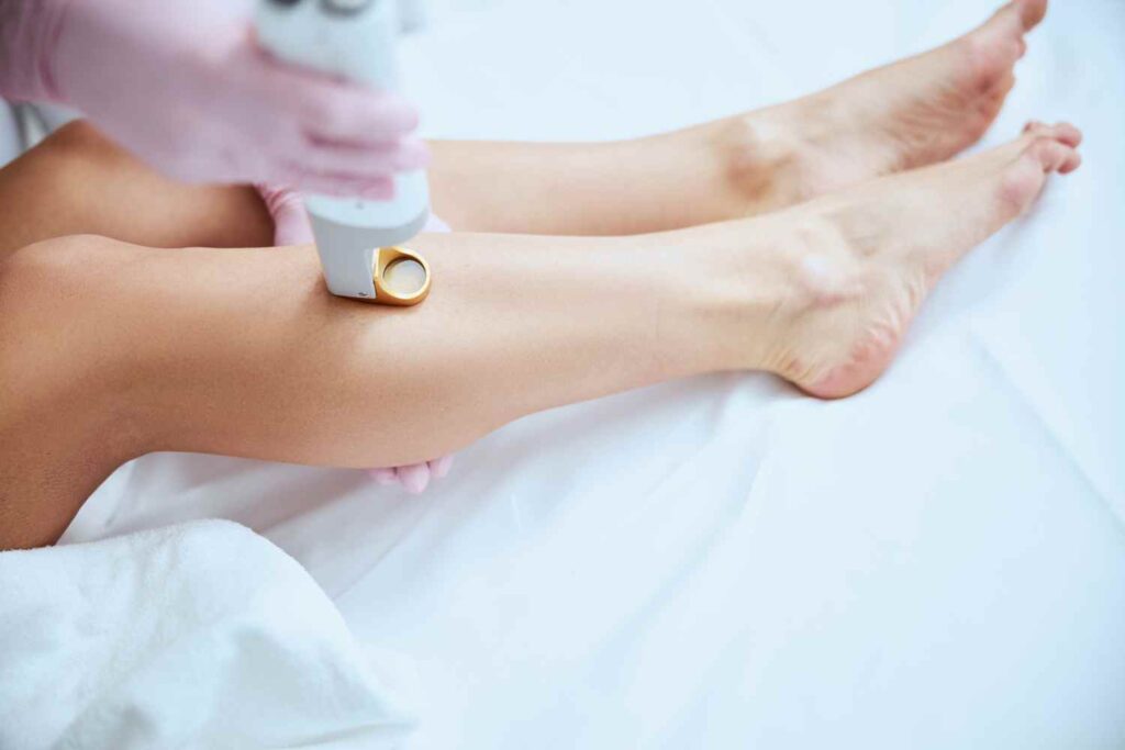 Leg laser hair removal