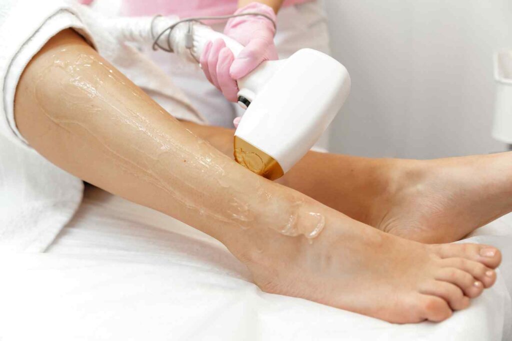 Leg laser hair removal