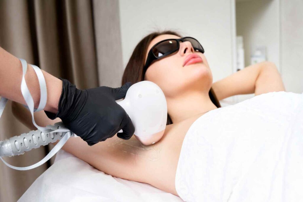 laser hair removal