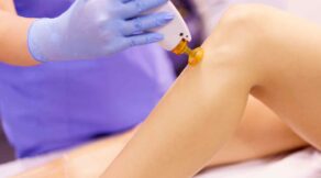 leg laser hair removal